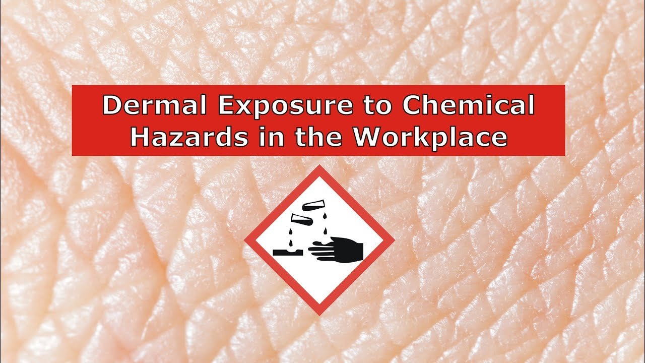 UV Risk: The Workplace Hazard Boards Overlook